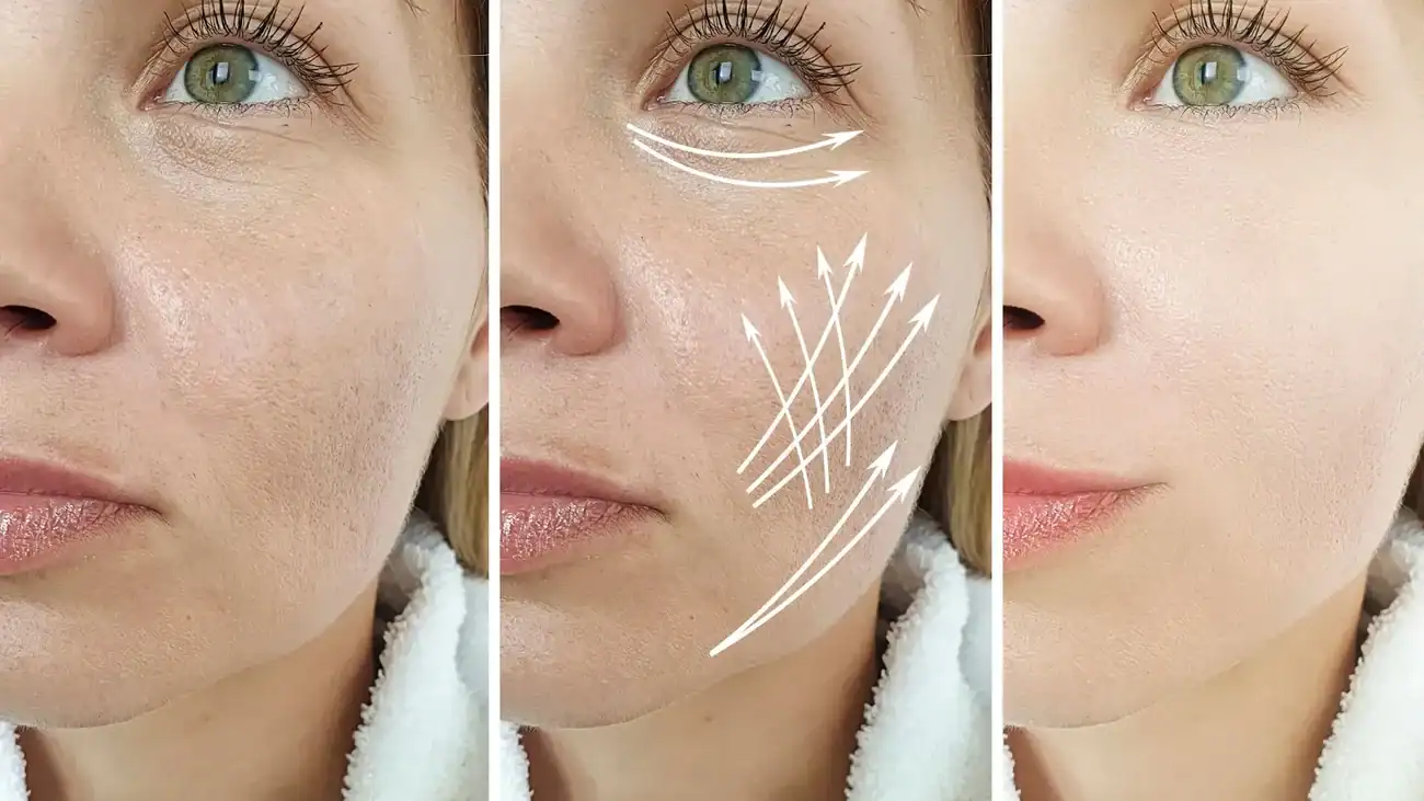 Can One Treatment Really Tackle More Than One Skin Concern Atherstone?