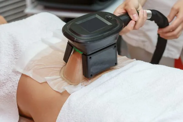 Image of person having fat freezing treatment to help weight gain Atherstone