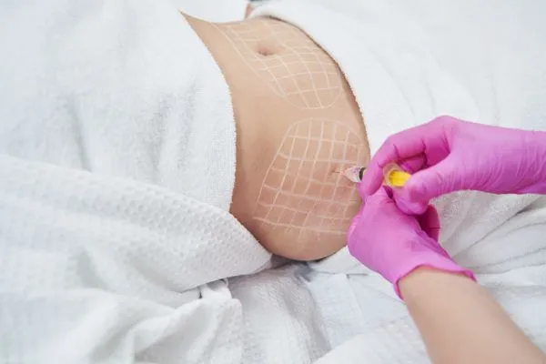 image of fat dissolving injections on love handles to help combat weight gain Atherstone