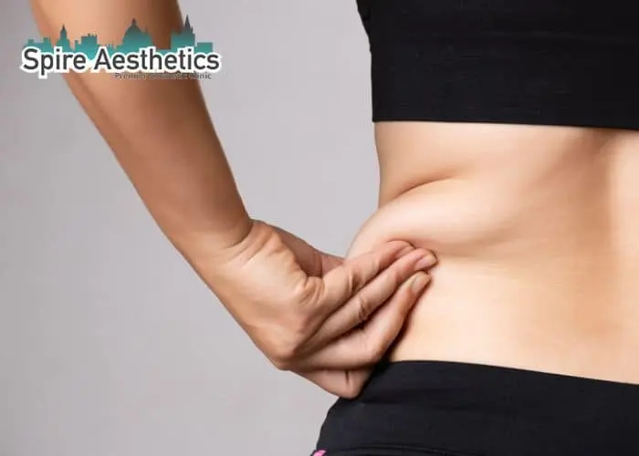 Image of woman pinching fat on their hips Atherstone. Fat Freezing treatment