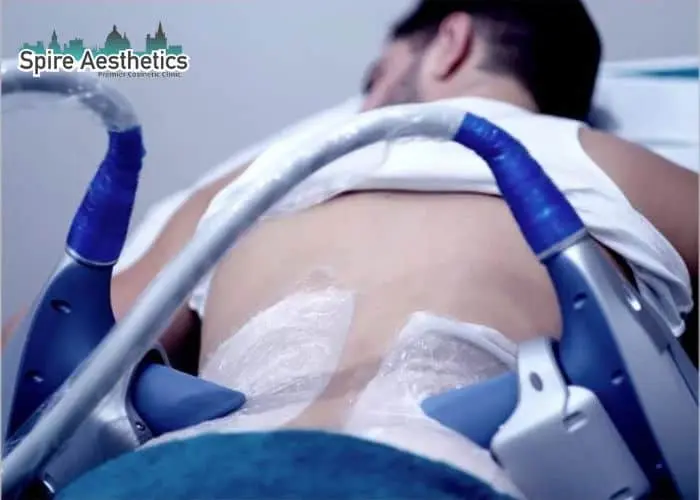 Man having fat freezing treatment done on love handles before a competitions Atherstone to create a sculpted look.
