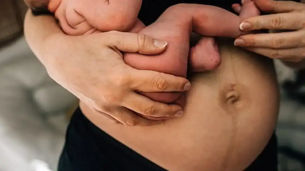 Why Is My Stomach Still Big After Pregnancy Atherstone?